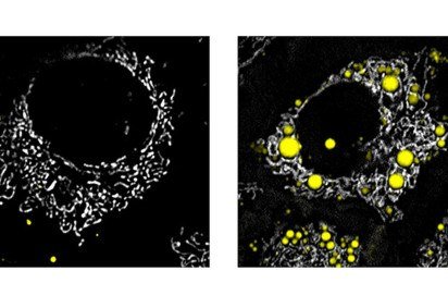 C&eacute;lulas do f&iacute;gado vistas sob microscopia de fluoresc&ecirc;ncia: &agrave; esquerda, c&eacute;lulas sadias; &agrave; direita, em amarelo, destacam-se got&iacute;culas de gordura. Pesquisa revelou que ativar o receptor ER&beta; induz o &oacute;rg&atilde;o a oxidar completamente esses lip&iacute;dios para gerar energia -  (crédito: D&eacute;bora Santos Rocha et al./Comprehensive Physiology) -C&eacute;lulas do f&iacute;gado vistas sob microscopia de fluoresc&ecirc;ncia: &agrave; esquerda, c&eacute;lulas sadias; &agrave; direita, em amarelo, destacam-se got&iacute;culas de gordura. Pesquisa revelou que ativar o receptor ER&beta; induz o &oacute;rg&atilde;o a oxidar completamente esses lip&iacute;dios para gerar energia -  (crédito: D&eacute;bora Santos Rocha et al./Comprehensive Physiology)