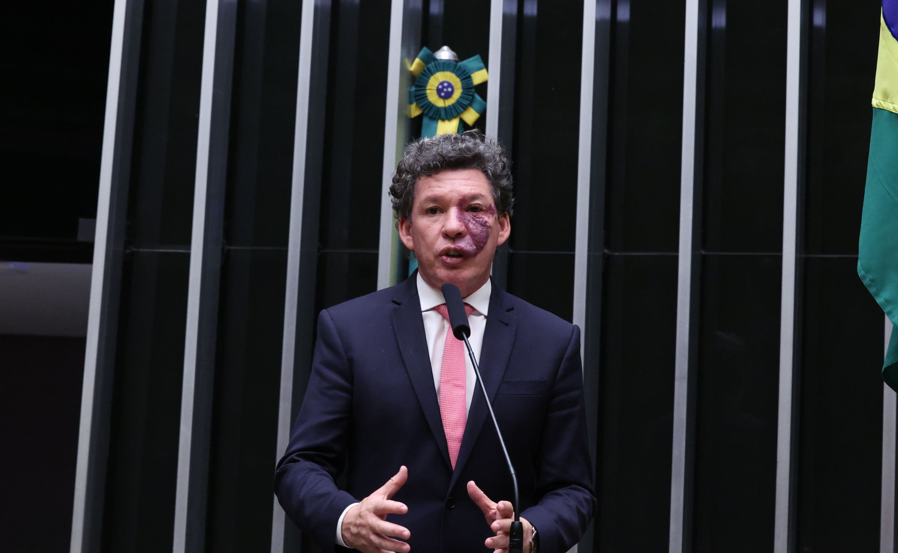 Setor produtivo eleva críticas contra fim da taxa das blusinhas