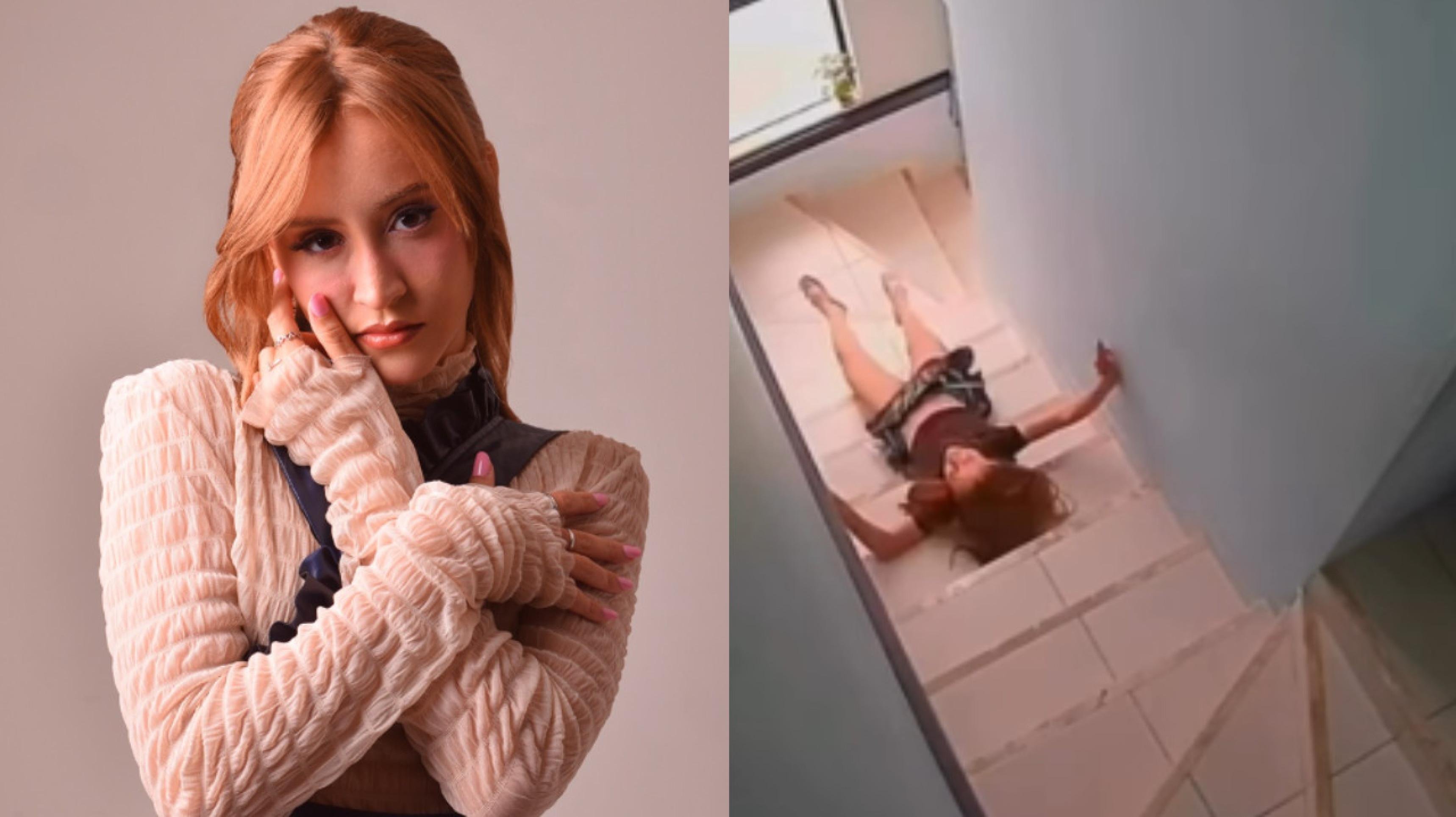 Influencer cai de escada e recebe diagnóstico trágico; veja imagens