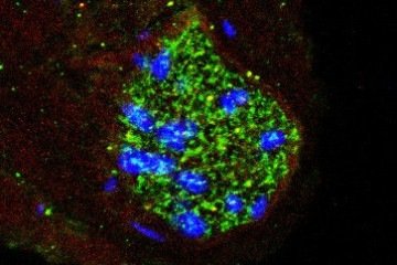 Imagem do nervo depressor aórtico de cobaia mostrando a presença da molécula inflamatória interleucina-1β (em verde) e de seu receptor (em vermelho), a estrutura à qual essa molécula se liga para exercer seus efeitos. Os núcleos das células aparecem em azul - (crédito: Divulgação/Fernanda Brognara et al.) Imagem do nervo depressor aórtico de cobaia mostrando a presença da molécula inflamatória interleucina-1β (em verde) e de seu receptor (em vermelho), a estrutura à qual essa molécula se liga para exercer seus efeitos. Os núcleos das células aparecem em azul - (crédito: Divulgação/Fernanda Brognara et al.)