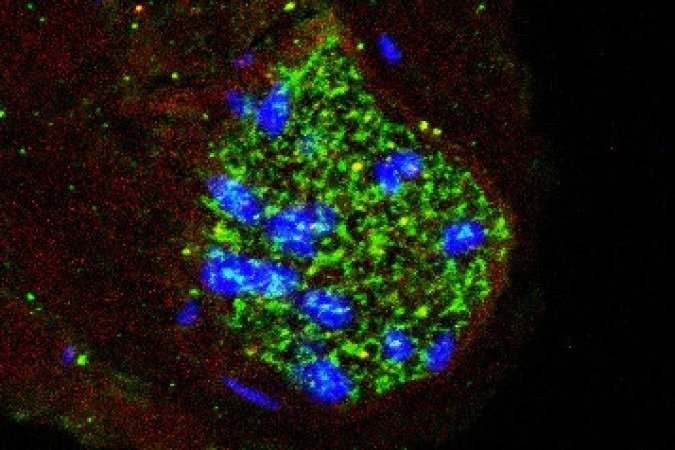 Imagem do nervo depressor aórtico de cobaia mostrando a presença da molécula inflamatória interleucina-1β (em verde) e de seu receptor (em vermelho), a estrutura à qual essa molécula se liga para exercer seus efeitos. Os núcleos das células aparecem em azul - (crédito: Divulgação/Fernanda Brognara et al.) Imagem do nervo depressor aórtico de cobaia mostrando a presença da molécula inflamatória interleucina-1β (em verde) e de seu receptor (em vermelho), a estrutura à qual essa molécula se liga para exercer seus efeitos. Os núcleos das células aparecem em azul - (crédito: Divulgação/Fernanda Brognara et al.)