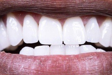 Verduras como a couve kale podem nos ajudar a manter uma microbiota oral saudável -  (crédito: Getty Images)