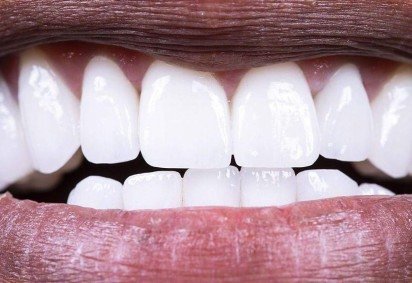 Verduras como a couve kale podem nos ajudar a manter uma microbiota oral saudável -  (crédito: Getty Images) -Verduras como a couve kale podem nos ajudar a manter uma microbiota oral saudável -  (crédito: Getty Images)