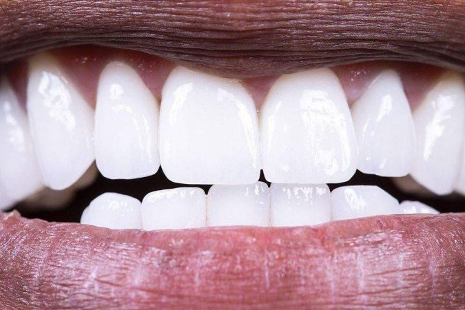Verduras como a couve kale podem nos ajudar a manter uma microbiota oral saudável - (crédito: Getty Images) Verduras como a couve kale podem nos ajudar a manter uma microbiota oral saudável - (crédito: Getty Images)