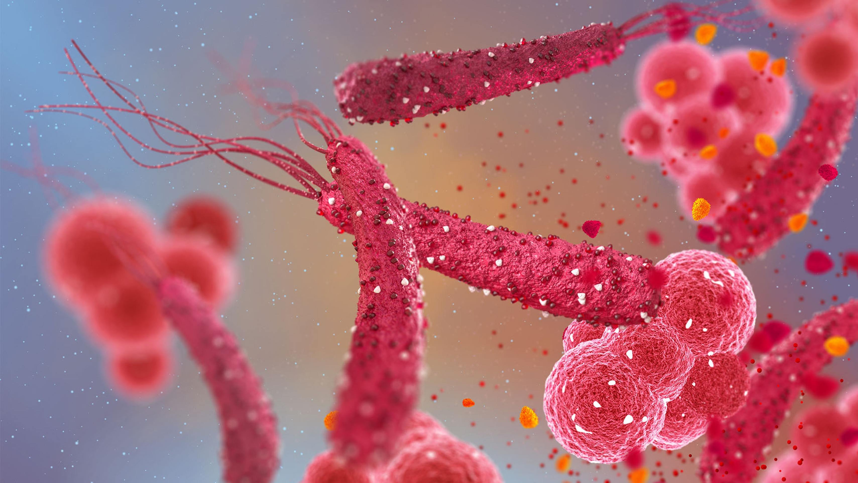Bactéria 'H. pylori' é associada ao câncer colorretal em pesquisa