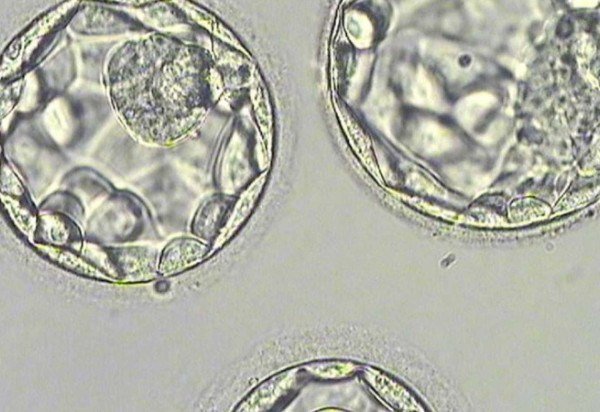 Shaare Zedek IVF Unit