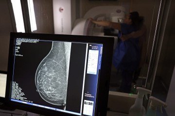 Havendo indicação médica, os planos de saúde terão de oferecer a mamografia independentemente da idade ou do gênero do paciente -  (crédito: José Cruz/Agência Brasil)