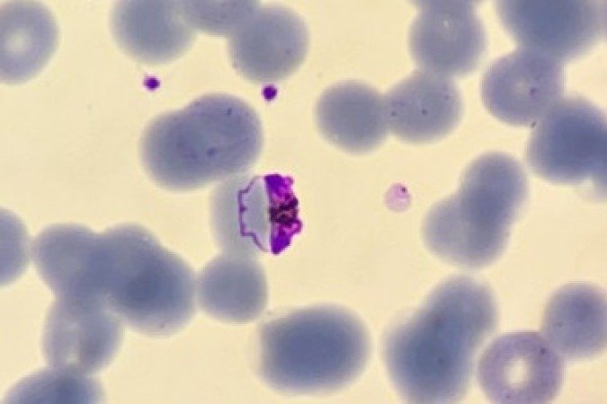 O Plasmodium falciparum, parasita da malária alvo de pesquisa para novos tratamentos da doença - (crédito: Shutterstock) O Plasmodium falciparum, parasita da malária alvo de pesquisa para novos tratamentos da doença - (crédito: Shutterstock)