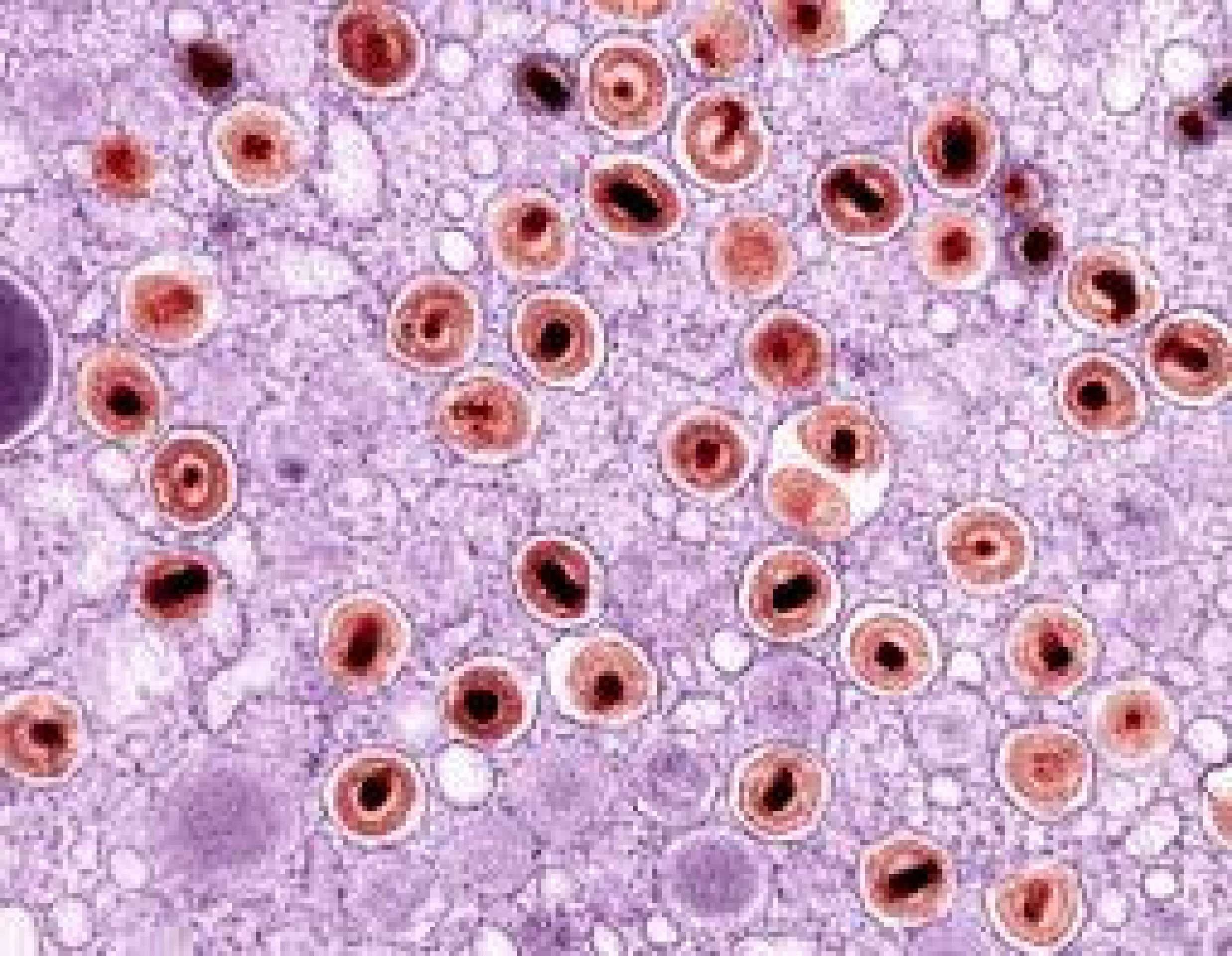 Herpes-zóster: quando uma dor comum merece atenção