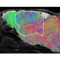 Mapa das fibras nervosas no cérebro de um camundongo xenocortical: as linhas brancas delimitam a área preenchida com tecido humano  -  (crédito: S. Pasca, Universidade de Stanford/Divulgação )