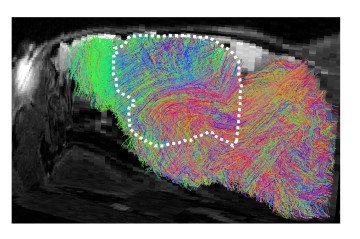 Mapa das fibras nervosas no cérebro de um camundongo xenocortical: as linhas brancas delimitam a área preenchida com tecido humano
- (crédito: S. Pasca, Universidade de Stanford/Divulgação ) Mapa das fibras nervosas no cérebro de um camundongo xenocortical: as linhas brancas delimitam a área preenchida com tecido humano
- (crédito: S. Pasca, Universidade de Stanford/Divulgação )