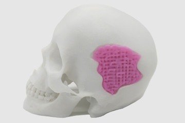 Vidro bioativo imprimível em 3D (em rosa): promessa na regeneração de estruturas ósseas -  (crédito: Adaptado ACS)