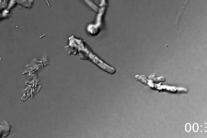 A descoberta da ameba de fogo em ambiente microscópico expande o conhecimento sobre a vida complexa em temperaturas extremas - (crédito: Beryl Rappaport/Nasa) A descoberta da ameba de fogo em ambiente microscópico expande o conhecimento sobre a vida complexa em temperaturas extremas - (crédito: Beryl Rappaport/Nasa)
