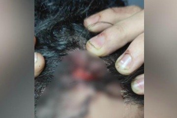 Motorista de app é brutalmente agredido no Guará -  (crédito: Material cedido ao Correio)