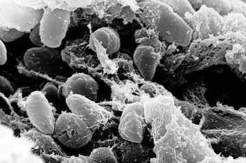 Segundo a OMS, a peste pneumônica é uma infecção pulmonar altamente contagiosa transmitida por meio de gotículas - (crédito: Domínio Público) Segundo a OMS, a peste pneumônica é uma infecção pulmonar altamente contagiosa transmitida por meio de gotículas - (crédito: Domínio Público)