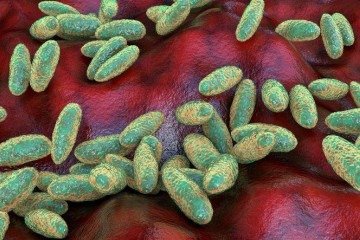O que é a peste pneumônica e como ela se espalha? -  (crédito: BBC Geral)