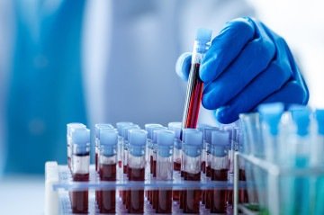 O sistema reúne dados genéticos, epidemiológicos e de estilo de vida de pessoas com e sem câncer - (crédito: Reprodução / Agência Fapesp / Shutterstock) O sistema reúne dados genéticos, epidemiológicos e de estilo de vida de pessoas com e sem câncer - (crédito: Reprodução / Agência Fapesp / Shutterstock)