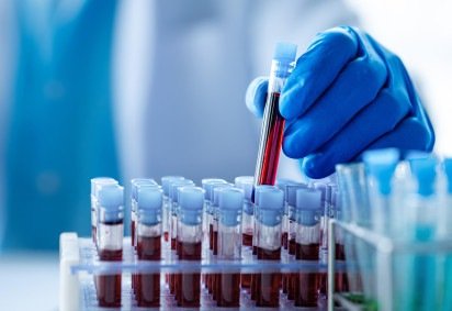 O sistema reúne dados genéticos, epidemiológicos e de estilo de vida de pessoas com e sem câncer -  (crédito: Reprodução / Agência Fapesp / Shutterstock) -O sistema reúne dados genéticos, epidemiológicos e de estilo de vida de pessoas com e sem câncer -  (crédito: Reprodução / Agência Fapesp / Shutterstock)