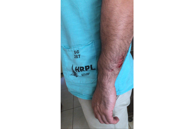 Técnico em enfermagem do Hospital Regional de Planaltina (HRPL), Fúlvio Lavareda, 36 anos, foi agredido com socos por acompanhante de paciente - (crédito: Arquivo pessoal) Técnico em enfermagem do Hospital Regional de Planaltina (HRPL), Fúlvio Lavareda, 36 anos, foi agredido com socos por acompanhante de paciente - (crédito: Arquivo pessoal)