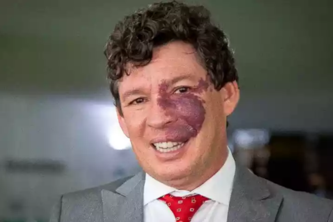 Reginaldo Lopes, deputado federal de Minas Gerais eleito pelo PT - (crédito: Divulgação/PT) Reginaldo Lopes, deputado federal de Minas Gerais eleito pelo PT - (crédito: Divulgação/PT)