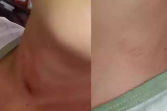 Menino desmaiou ao ser enforcado - suspeito da agressão, deverá ser ouvido nesta semana pela PolÃcia Civil. - (crédito: Arquivo Pessoal/Reisla Naiara) Menino desmaiou ao ser enforcado - suspeito da agressão, deverá ser ouvido nesta semana pela PolÃcia Civil. - (crédito: Arquivo Pessoal/Reisla Naiara)