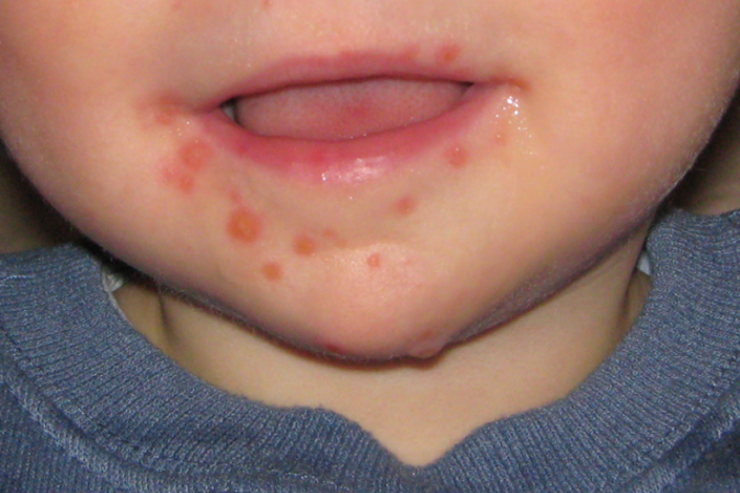  (crédito: MidgleyDJ/WikiEN)