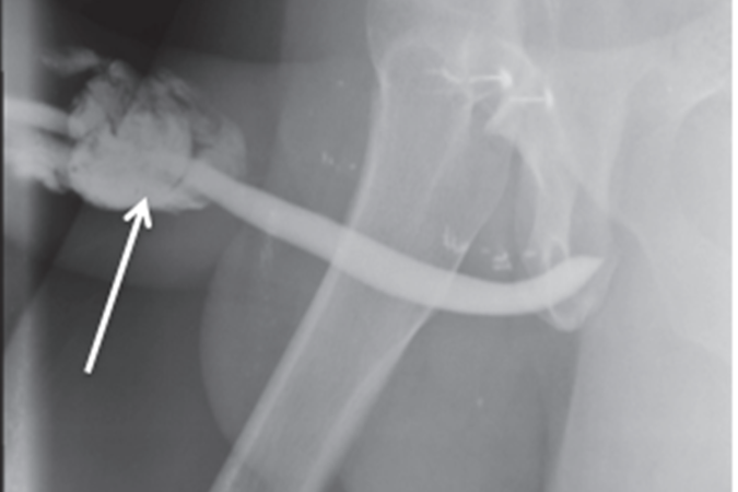 (crédito: Reprodução/ International Journal of Surgery Case Reports) (crédito: Reprodução/ International Journal of Surgery Case Reports)