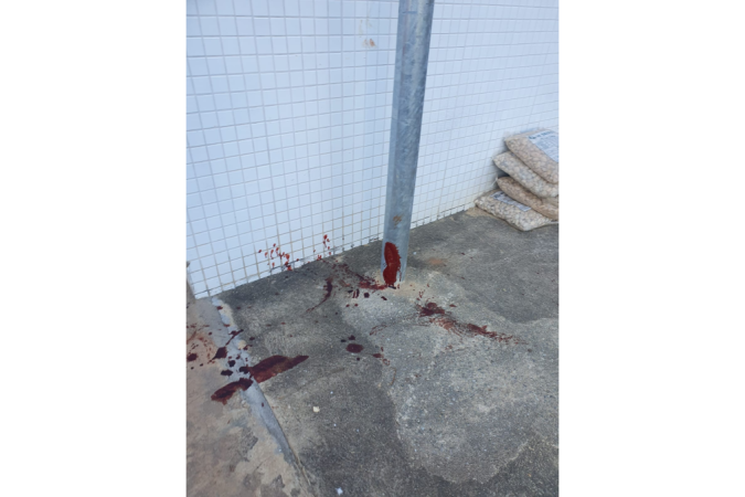 Na madrugada desta terça-feira (18/7), um homem de 39 anos em situação de rua foi esfaqueado na 314 Norte. Os moradores da quadra destacam a insegurança no local.
- (crédito: Material cedido ao Correio) Na madrugada desta terça-feira (18/7), um homem de 39 anos em situação de rua foi esfaqueado na 314 Norte. Os moradores da quadra destacam a insegurança no local.
- (crédito: Material cedido ao Correio)