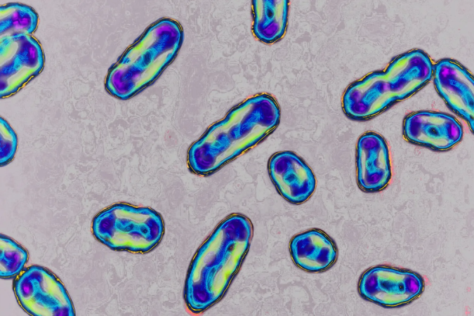 Causada pela bactéria <em>Yersinia pestis</em>, a peste bubônica é tratada atualmente com mais facilidade com os antibióticos modernos -  (crédito: Getty Images)