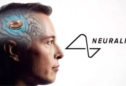 Em 28/01, a Neuralink, empresa do bilionário Elon Musk, realizou com sucesso o primeiro implante de um chip cerebral em um ser humano. -  (crédito: divulgação)