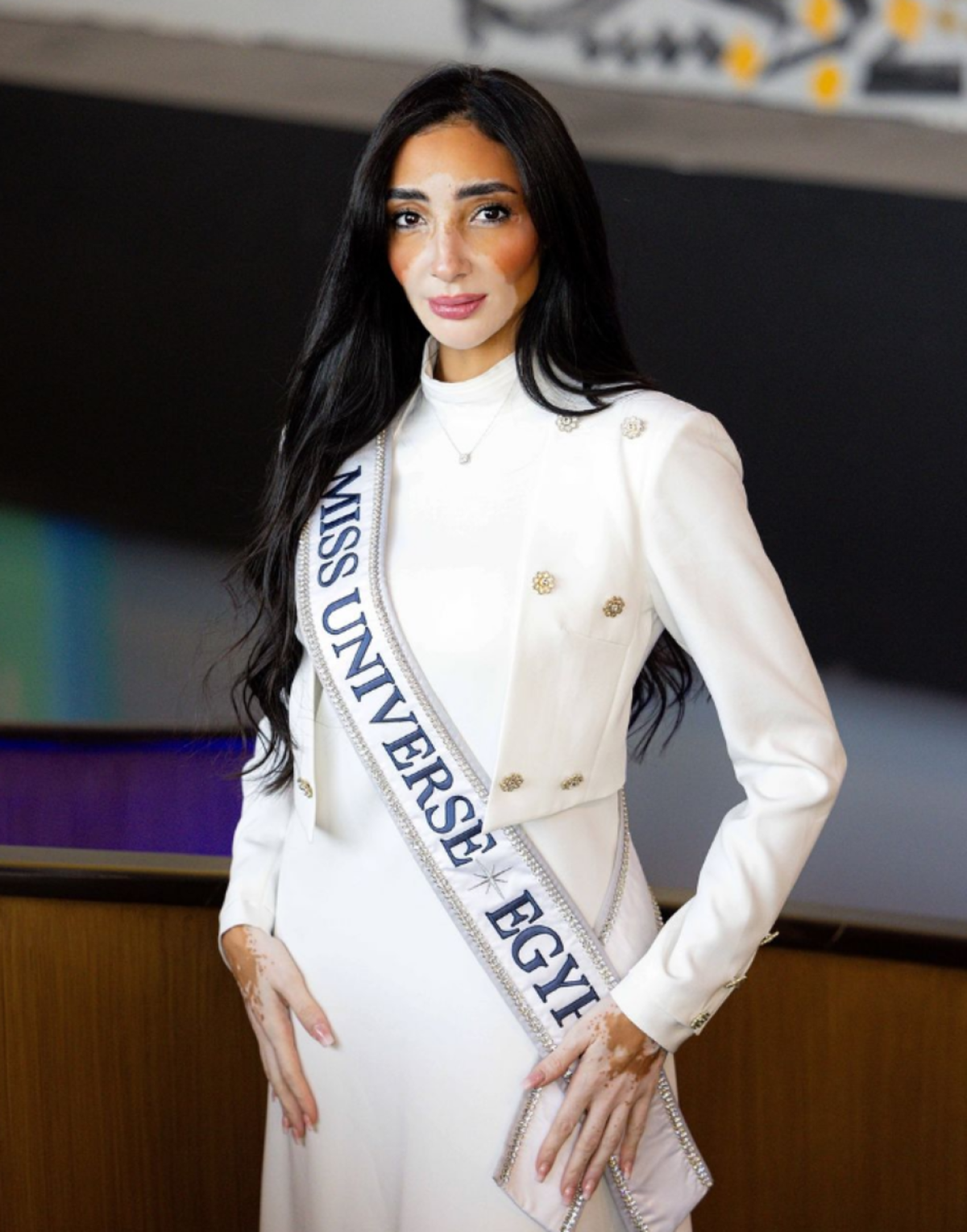 A modelo com vitiligo que chegou às semifinais do Miss Universo