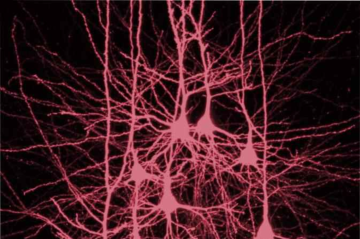 A equipe utilizou um tecido cerebral humano intacto — algo extremamente raro — para entender como funciona os processos que são fundamentais na formação da memória durante o sono profundo -  (crédito: Reprodução/Charité/Sabine Grosser)