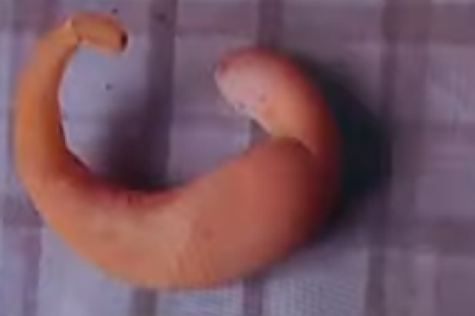 Fatores como o calor, a superlotação dos galinheiros, as doenças e os estresse das aves podem atrapalhar a postura da galinha e causar anormalidade do ovo — como o formato meia-lua -  (crédito: Reprodução/Youtube GloboRural)