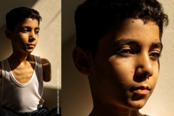O retrato mostra Mahmoud Ajjour, que teve um braço decepado e outro mutilado em março de 2024, durante um bombardeio israelense na Cidade de Gaza
 -  (crédito: World Press Photo)
