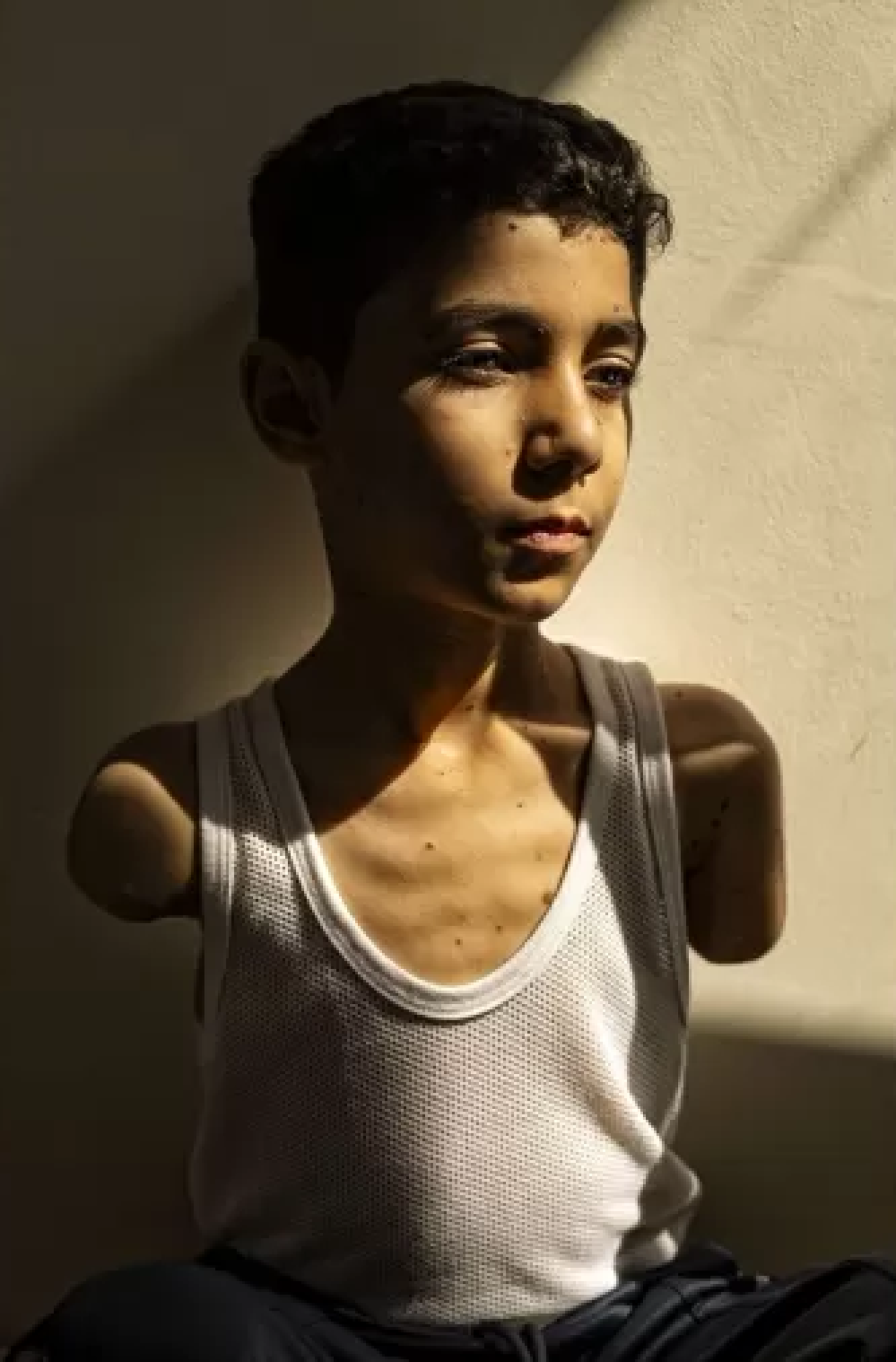 O retrato mostra Mahmoud Ajjour, que teve um braço decepado e outro mutilado em março de 2024, durante um bombardeio israelense na Cidade de Gaza