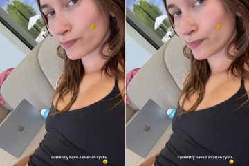 Hailey Bieber expõe diagnóstico delicado em meio à crise
 -  (crédito: Redes Sociais)