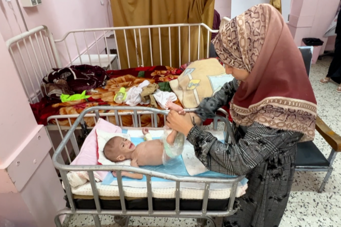 Um colega local da BBC registrou sinais inconfundíveis de desnutrição avançada no corpo da bebê Siwar - (crédito: BBC) Um colega local da BBC registrou sinais inconfundíveis de desnutrição avançada no corpo da bebê Siwar - (crédito: BBC)