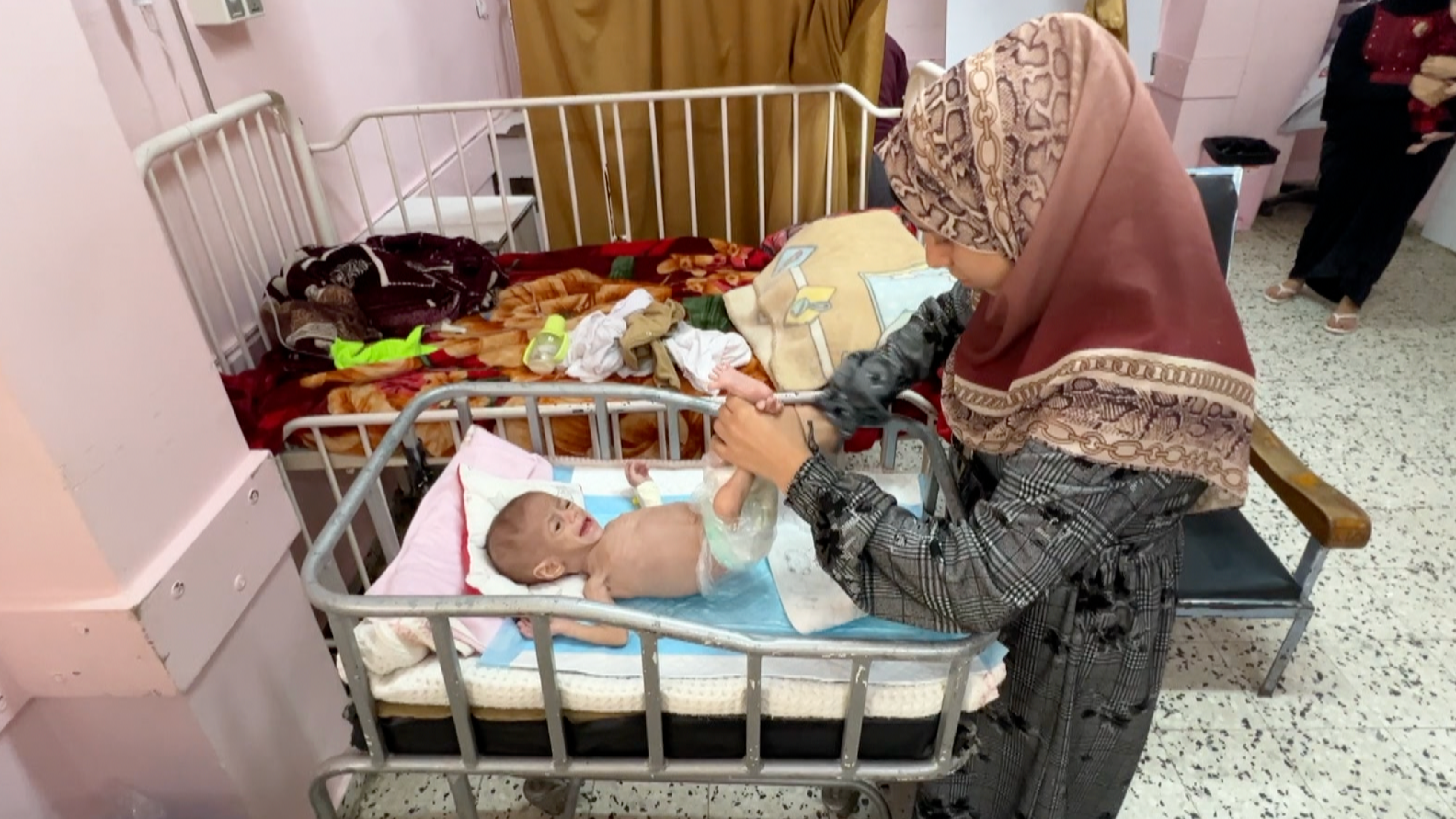 Um colega local da BBC registrou sinais inconfundíveis de desnutrição avançada no corpo da bebê Siwar -  (crédito: BBC)