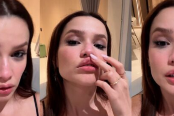 Juliette sofre acidente doméstico e vai parar no hospital
 -  (crédito: Redes Sociais)