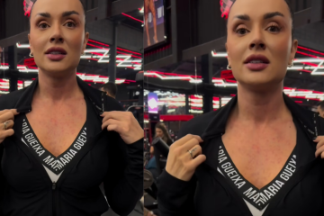 Juju Salimeni mostra reação alérgica: Juju Salimeni mostra reação alérgica: