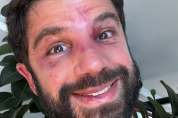 O ator Duda Nagle enfrentou um desafio de boxe contra o campeão Popó  -  (crédito: Reprodução Instagram @dudanagle )
