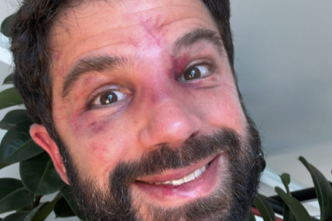 O ator Duda Nagle enfrentou um desafio de boxe contra o campeão Popó - (crédito: Reprodução Instagram @dudanagle ) O ator Duda Nagle enfrentou um desafio de boxe contra o campeão Popó - (crédito: Reprodução Instagram @dudanagle )