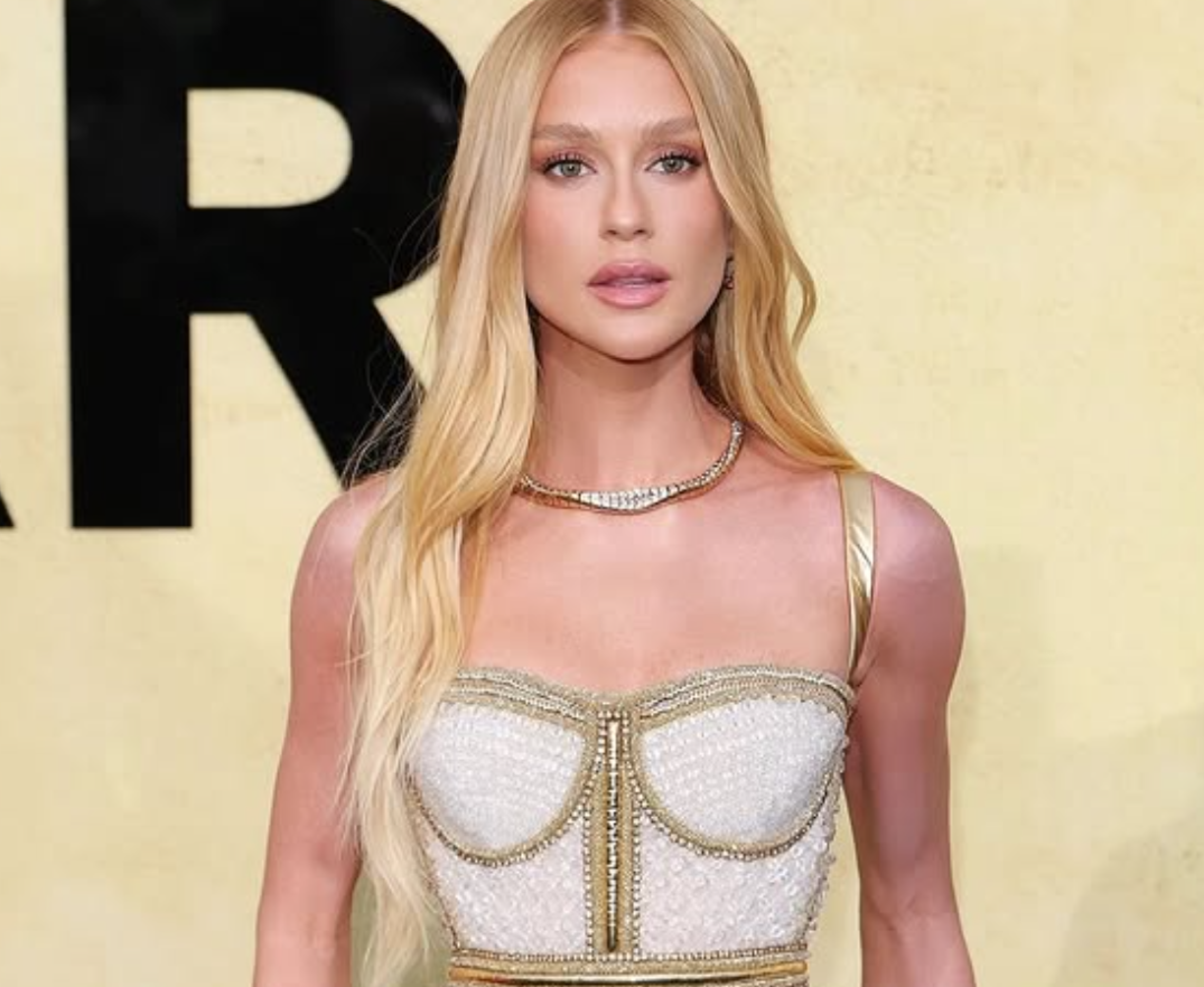 Marina Ruy Barbosa surge com braço roxo em Cannes e revela motivo
