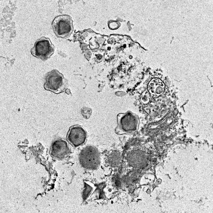 Uma infecção viral gigante na alga unicelular 'Florenciella' -  (crédito: Grieg Steward/Universidade do Havaí em Manoa)