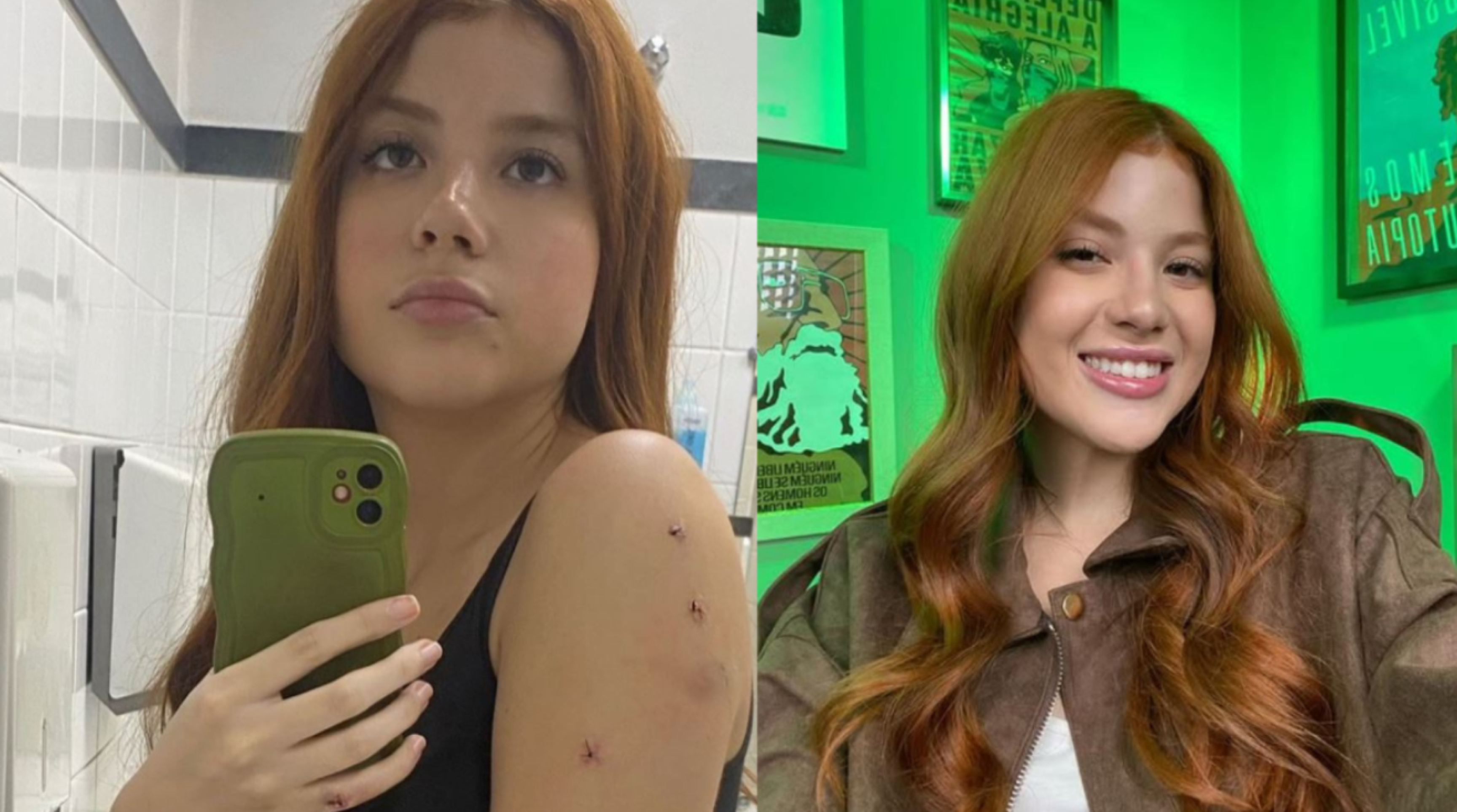 Influenciadora Laura Sabino foi vítima de tentativa de homicídio