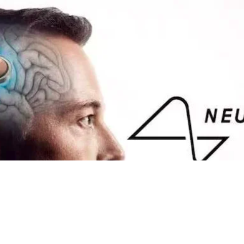 1_elon_musk_chip_divulgacao2-