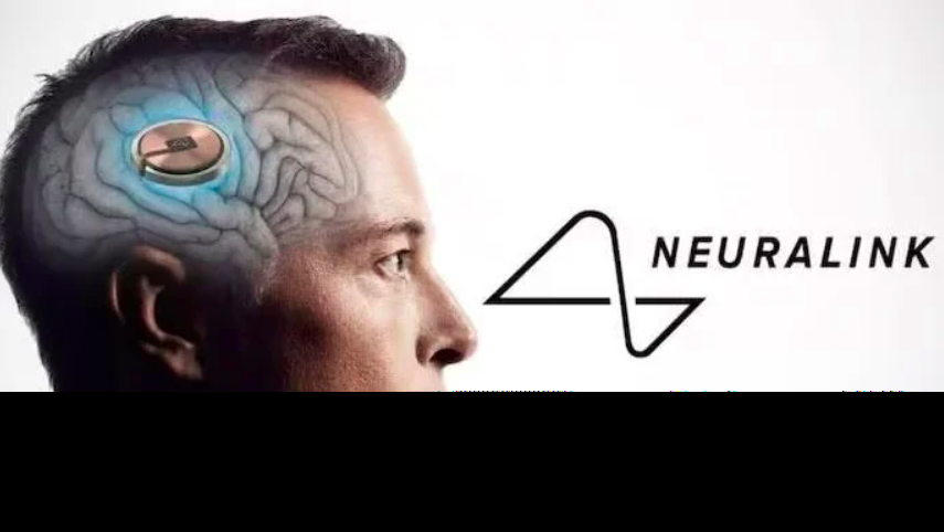 1_elon_musk_chip_divulgacao2-