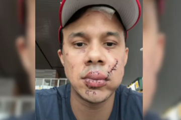 O agressor o atingiu com um soco, em seguida quebrou um copo e o agrediu no rosto várias vezes -  (crédito: Reprodução / Redes Sociais)