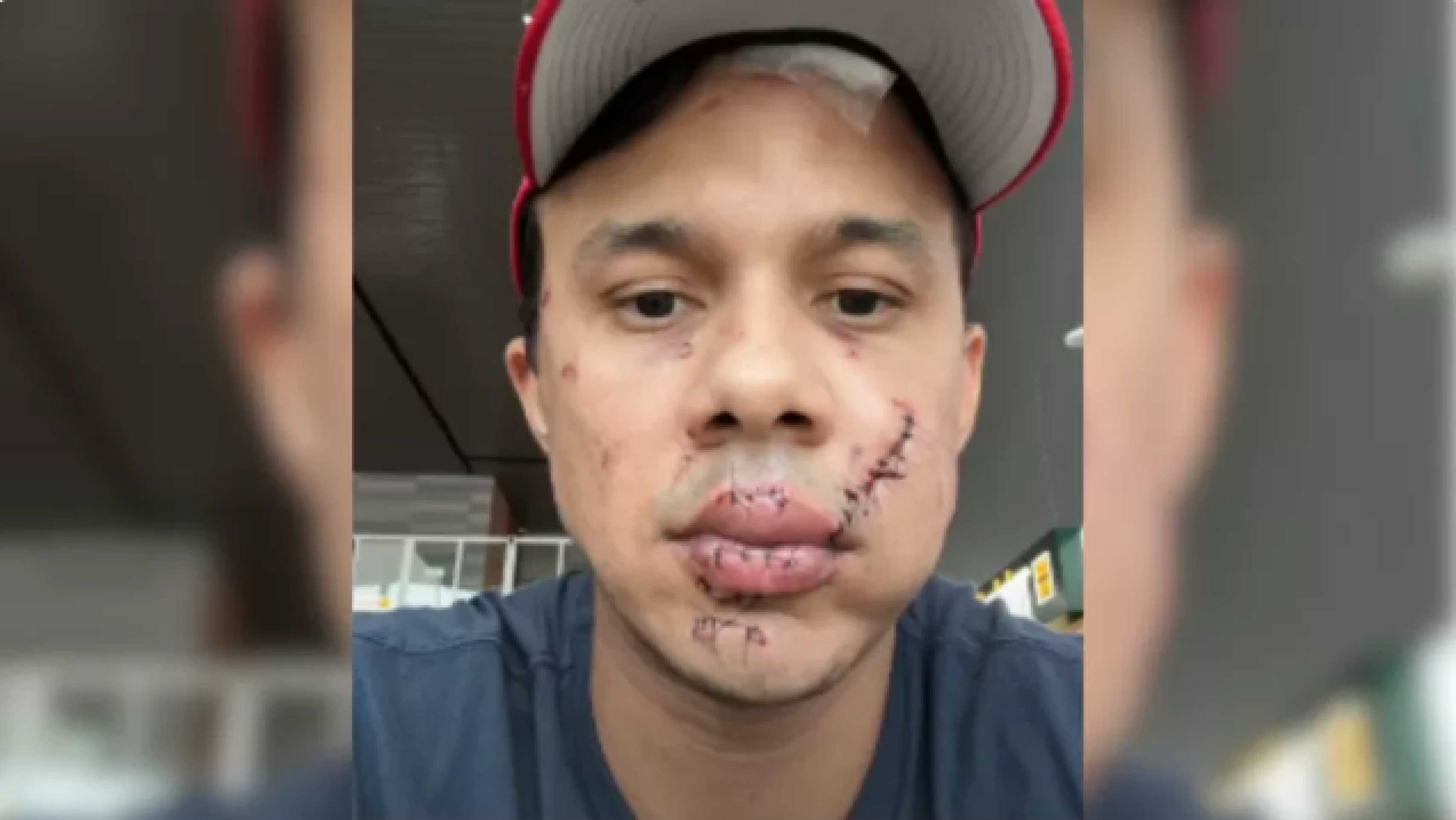 Vídeo: PCDF identifica agressor de personal em caso ocorrido em São Paulo