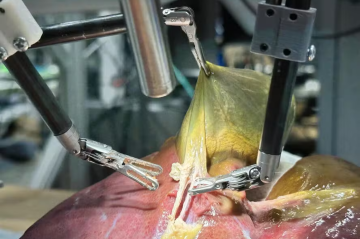 Robô realiza primeira cirurgia em tecido humano guiado totalmente por IA -  (crédito: Juo-Tung Chen / Johns Hopkins University)